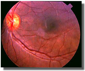 fundus OS