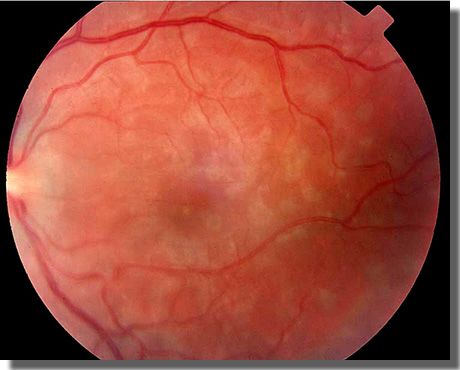 fundus OS