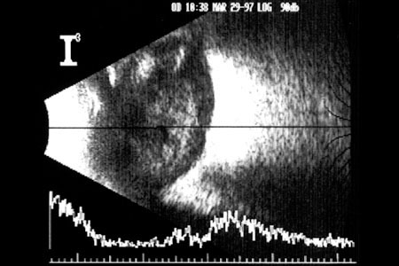 echogram