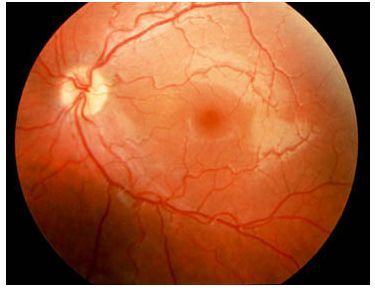 Fundus OS