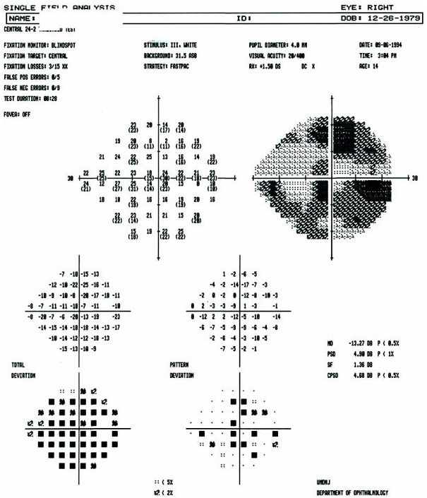 Visual field OD