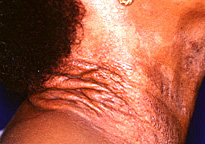 Side view of the neck region