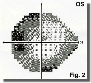 Visual field OS