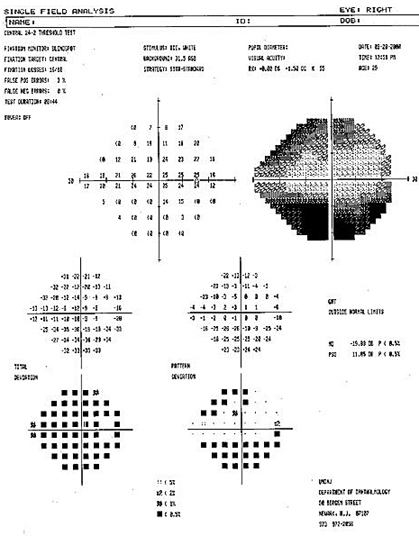 Visual Field Test