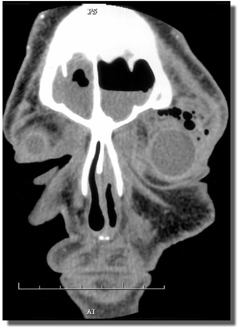 CT scan