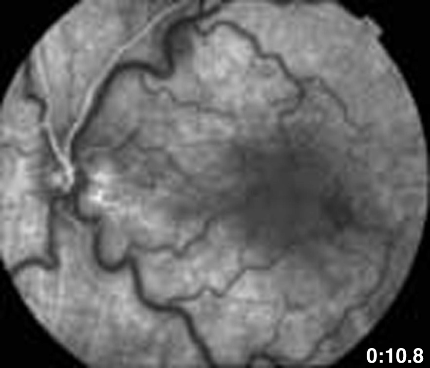 Arterial phase