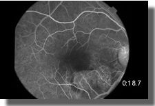 OD:arterial phase