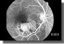 OD:venous phase