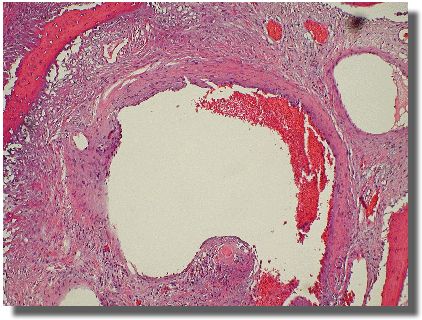 Histology slide