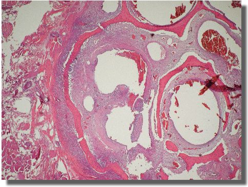 Histology slide